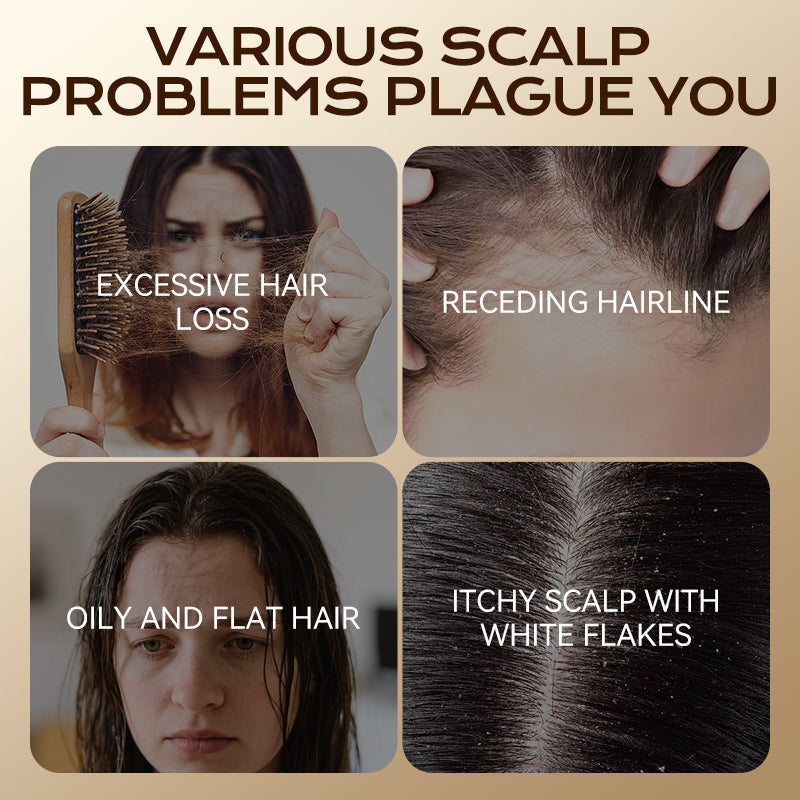 Herbal Hair Loss Prevention and Hair Growth Shampoo